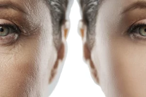 سلول‌های بنیادی