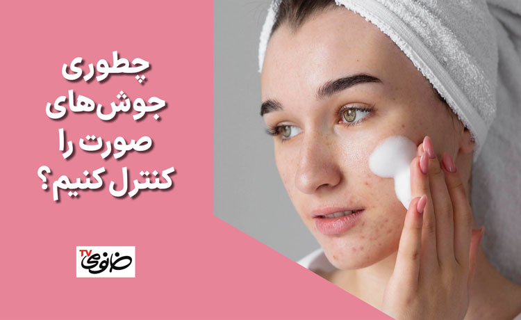چطوری جوش‌های صورت را کنترل کنیم؟